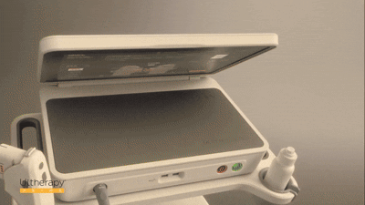 POINT 1. 커진 모니터로 시술 정확도 UP