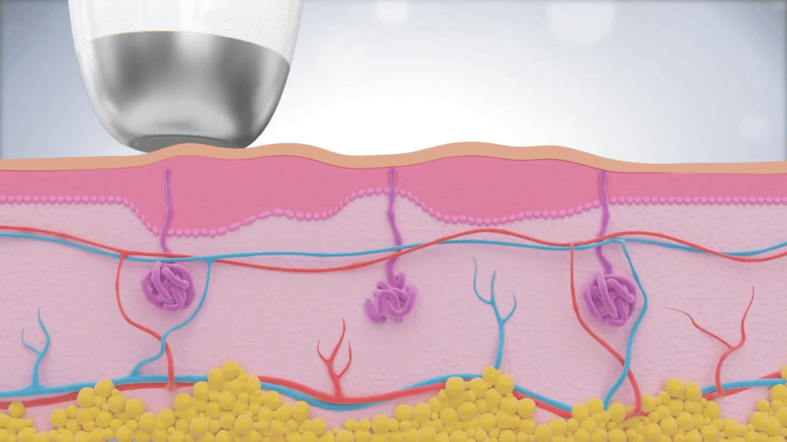 POINT 3. 빠른 속도