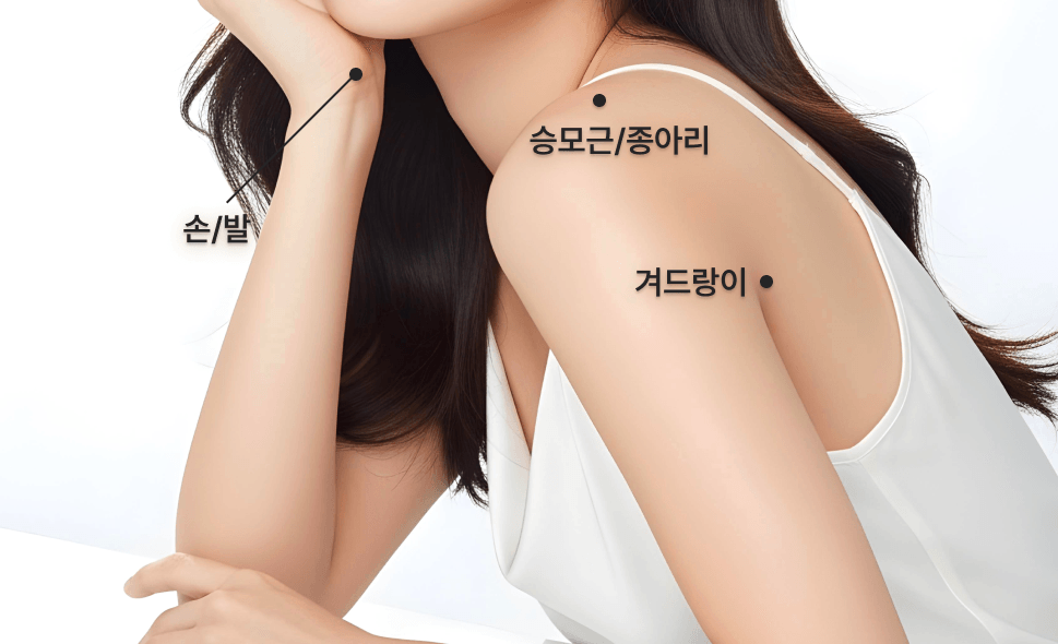 바디/다한증 보톡스 시술부위