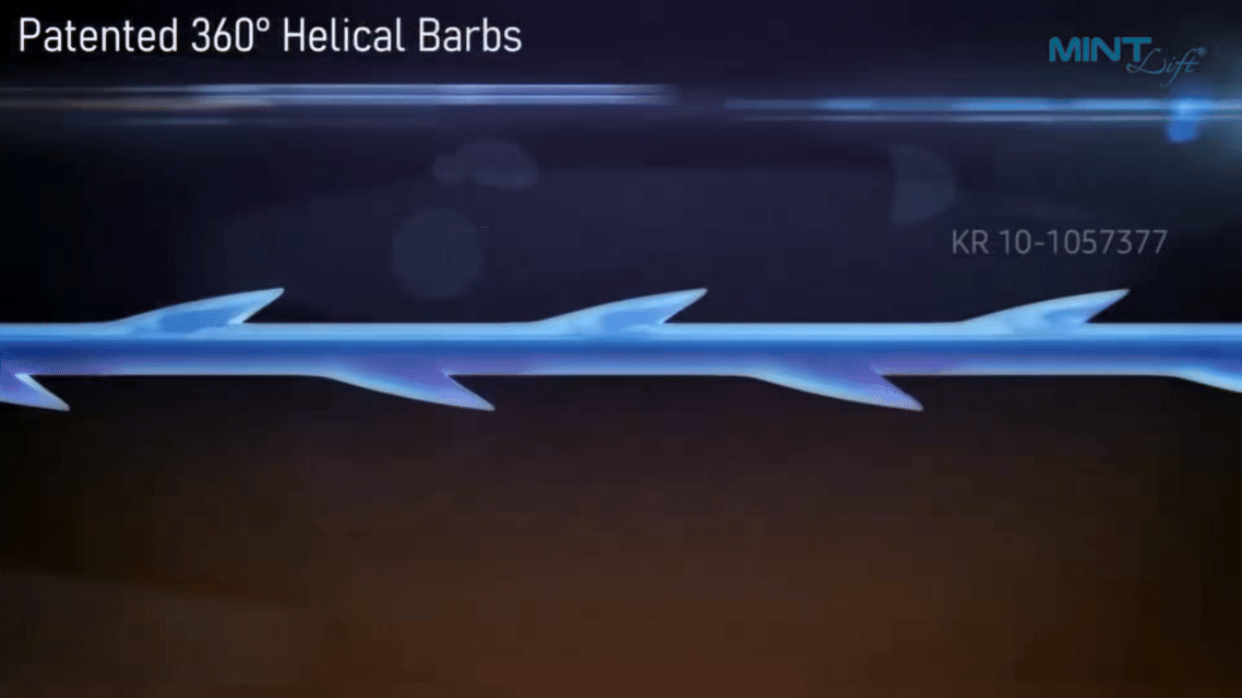 우수한 리프팅 효과